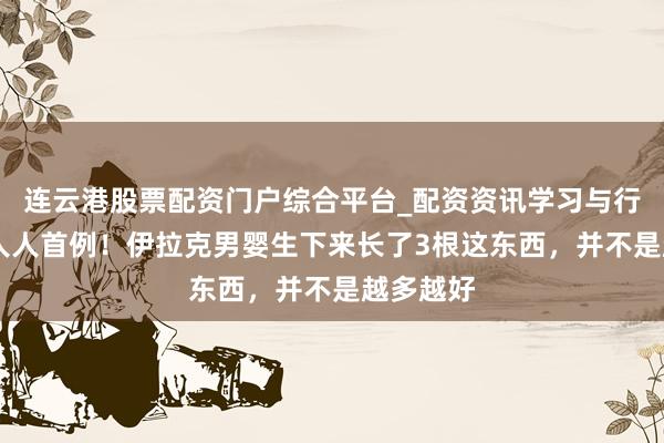 连云港股票配资门户综合平台_配资资讯学习与行情说明 人人首例！伊拉克男婴生下来长了3根这东西，并不是越多越好